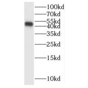 WB analysis of mouse liver tissue, using SMAD7 antibody (1/600 dilution).