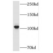 WB analysis of HEK-293 cells, using SMARCAL1 antibody (1/600 dilution).