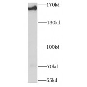 WB analysis of K-562 cells, using SMARCC1 antibody (1/1000 dilution).