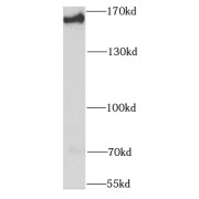 WB analysis of K-562 cells, using SMARCC1 antibody (1/1000 dilution).