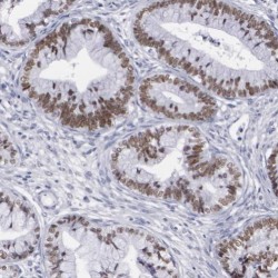 SWI/SNF Related, Matrix Associated, Actin Dependent Regulator of Chromatin, Subfamily D, Member 2 (SMARCD2) Antibody