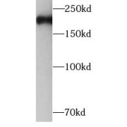 WB analysis of A375 cells, using SMMHC antibody (1/1000 dilution).