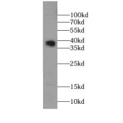 WB analysis of Raji cells, using SMN2 antibody (1/400 dilution).