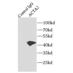 smooth muscle actin specific Antibody