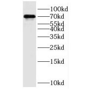 WB analysis of COLO 320 cells, using SMTNL2 antibody (1/500 dilution).