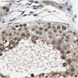 SMYD1-Specific Antibody
