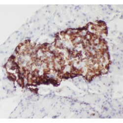 SET And MYND Domain-Containing Protein 4 (SMYD4) Antibody