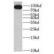 WB analysis of HepG2 cells, using SMYD4 antibody (1/300 dilution).