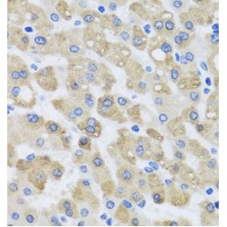 Synaptosomal-Associated Protein 29 (SNAP29) Antibody