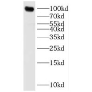 WB analysis of mouse brain tissue, using SNCAIP antibody (1/300 dilution).