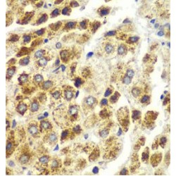 Staphylococcal Nuclease Domain-Containing Protein 1 (SND1) Antibody