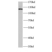 WB analysis of HeLa cells, using SND1 antibody (1/1000 dilution).