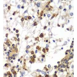Staphylococcal Nuclease Domain-Containing Protein 1 (SND1) Antibody