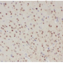 Small Nuclear Ribonucleoprotein U11/U12 Subunit 48 (SNRNP48) Antibody