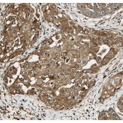 Small Nuclear Ribonucleoprotein Polypeptides B And B1 (SNRPB) Antibody