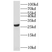 WB analysis of HepG2 cells, using SNRPB antibody (1/500 dilution).