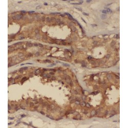 Small Nuclear Ribonucleoprotein Polypeptide G (SNRPG) Antibody