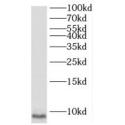 WB analysis of Jurkat cells, using SNRPG antibody (1/300 dilution).