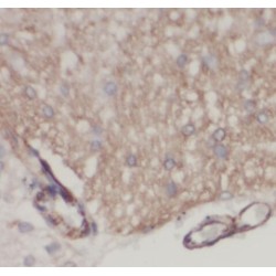 Snurportin 1 (SNUPN) Antibody