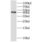 WB analysis of HeLa cells, using SNUPN antibody (1/2000 dilution).