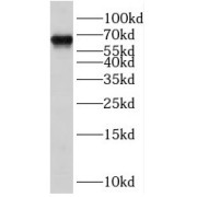 WB analysis of MCF-7 cells, using SNW1 antibody (1/600 dilution).