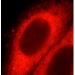 Sorting Nexin 17 (SNX17) Antibody