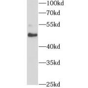 WB analysis of human brain tissue, using SNX17 antibody (1/300 dilution).
