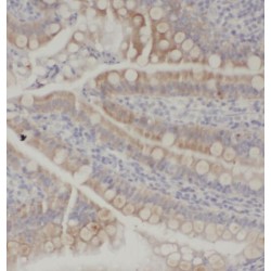 Sterol O-Acyltransferase 2 (SOAT2) Antibody