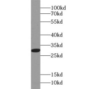 abx238100