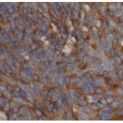 Superoxide Dismutase 1, Soluble (SOD1) Antibody