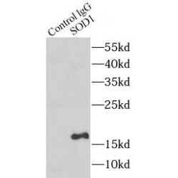 Superoxide Dismutase 1, Soluble (SOD1) Antibody
