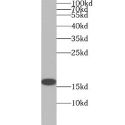 WB analysis of HEK-293 cells, using SOD1 antibody (1/1500 dilution).