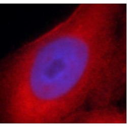 Superoxide Dismutase 2, Mitochondrial (SOD2) Antibody