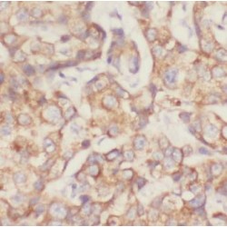 Superoxide Dismutase 2, Mitochondrial (SOD2) Antibody