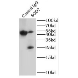 Superoxide Dismutase 2, Mitochondrial (SOD2) Antibody