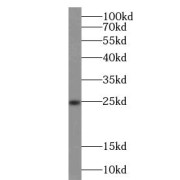 WB analysis of HeLa cells, using SOD2 antibody (1/1000 dilution).