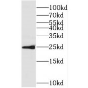 WB analysis of human heart tissue, using SOD3 antibody (1/1000 dilution).