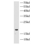 WB analysis of MCF-7 cells, using SST antibody (1/1000 dilution).