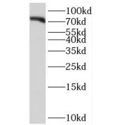 WB analysis of mouse brain tissue, using SORCS1 antibody (1/1000 dilution).