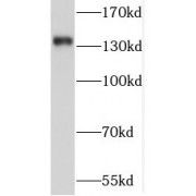 WB analysis of Jurkat cells, using SORCS2 antibody (1/500 dilution).
