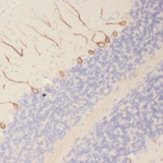 IHC-P analysis of human brain tissue, using SORLA antibody (1/50 dilution).