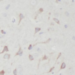 Sortilin (Sort1) Antibody