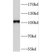 WB analysis of human brain tissue, using Sortilin antibody (1/1200 dilution).
