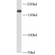 WB analysis of HeLa cells, using SOS1 antibody (1/1000 dilution).