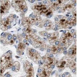 Sclerostin (SOST) Antibody