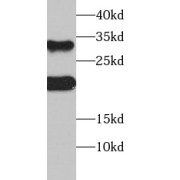 WB analysis of HeLa cells, using SOST antibody (1/1000 dilution).