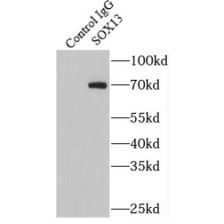 Sex Determining Region Y Box Protein 13 (SOX13) Antibody