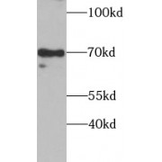 WB analysis of HepG2 cells, using SOX5 antibody (1/1000 dilution).