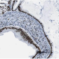 SP100 Nuclear Antigen (SP100) Antibody