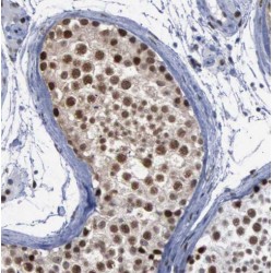 Sperm Associated Antigen 5 (SPAG5) Antibody
